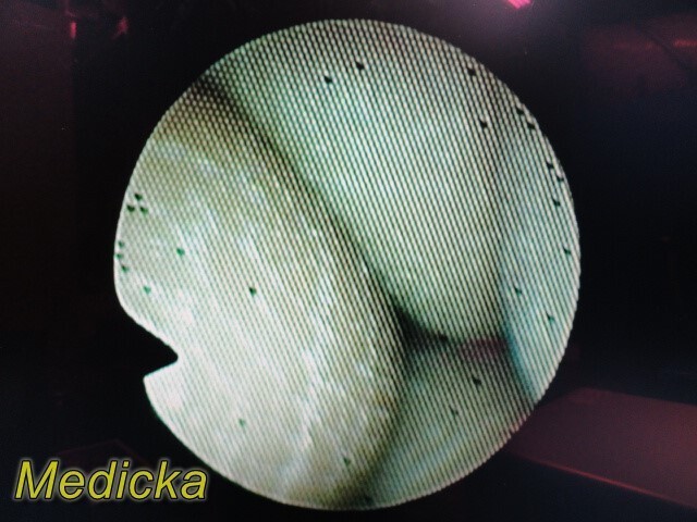 Olympus CHF-CB30S Fiber Optic Choledoscope Flex-Endoscope Read