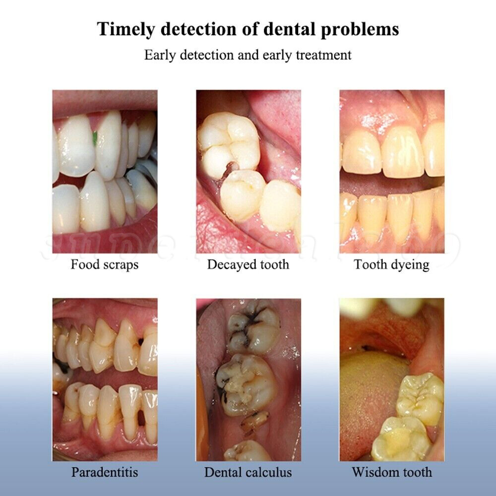 Wireless Oral Dental Intraoral Camera HD 1080p WIFI Endoscope Teeth Mirror ns