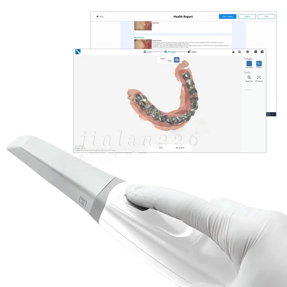 Dental Scanner with Scanning Software. No Need Calibration.