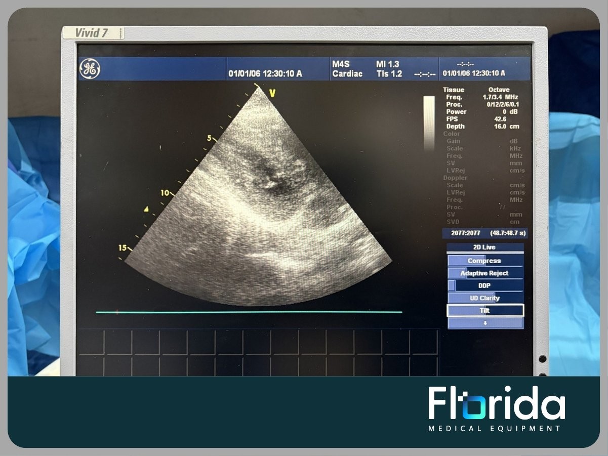 2012 GE M4S SECTOR ARRAY ULTRASOUND TRANSDUCER PROBE REF: 5129041 TESTED