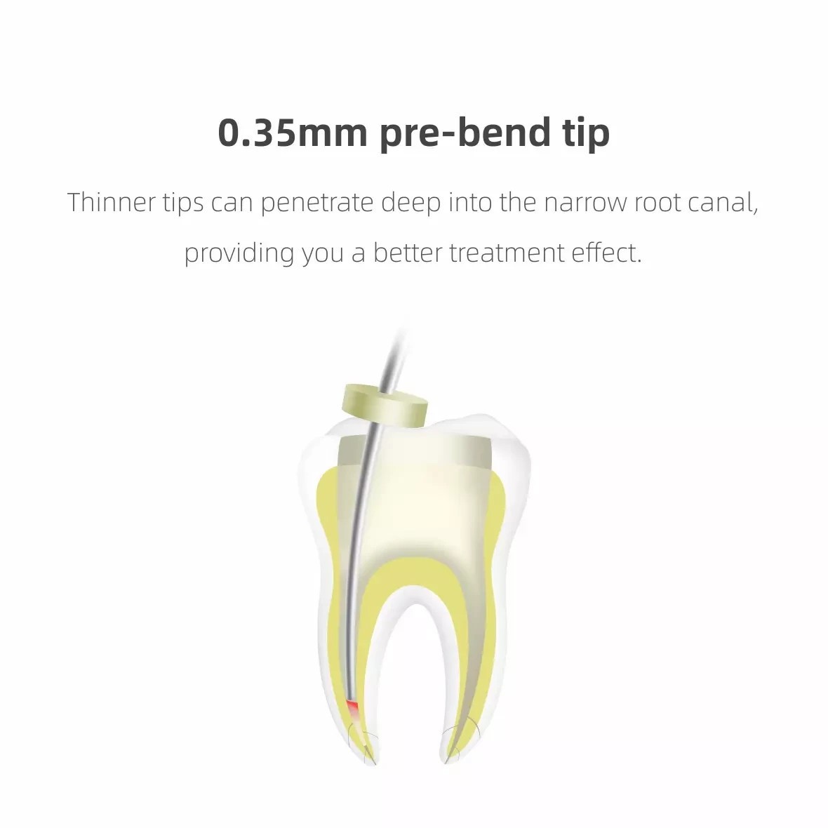 Woodpecker Cordless Dental Endo Gutta Percha Heated Pen/Gun Obturation System