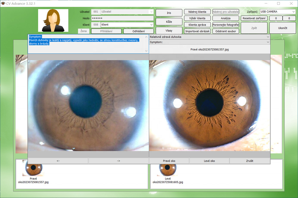 Analyzer Camera HD Iriscope Eye Camera with English Analysis Software for Eye US
