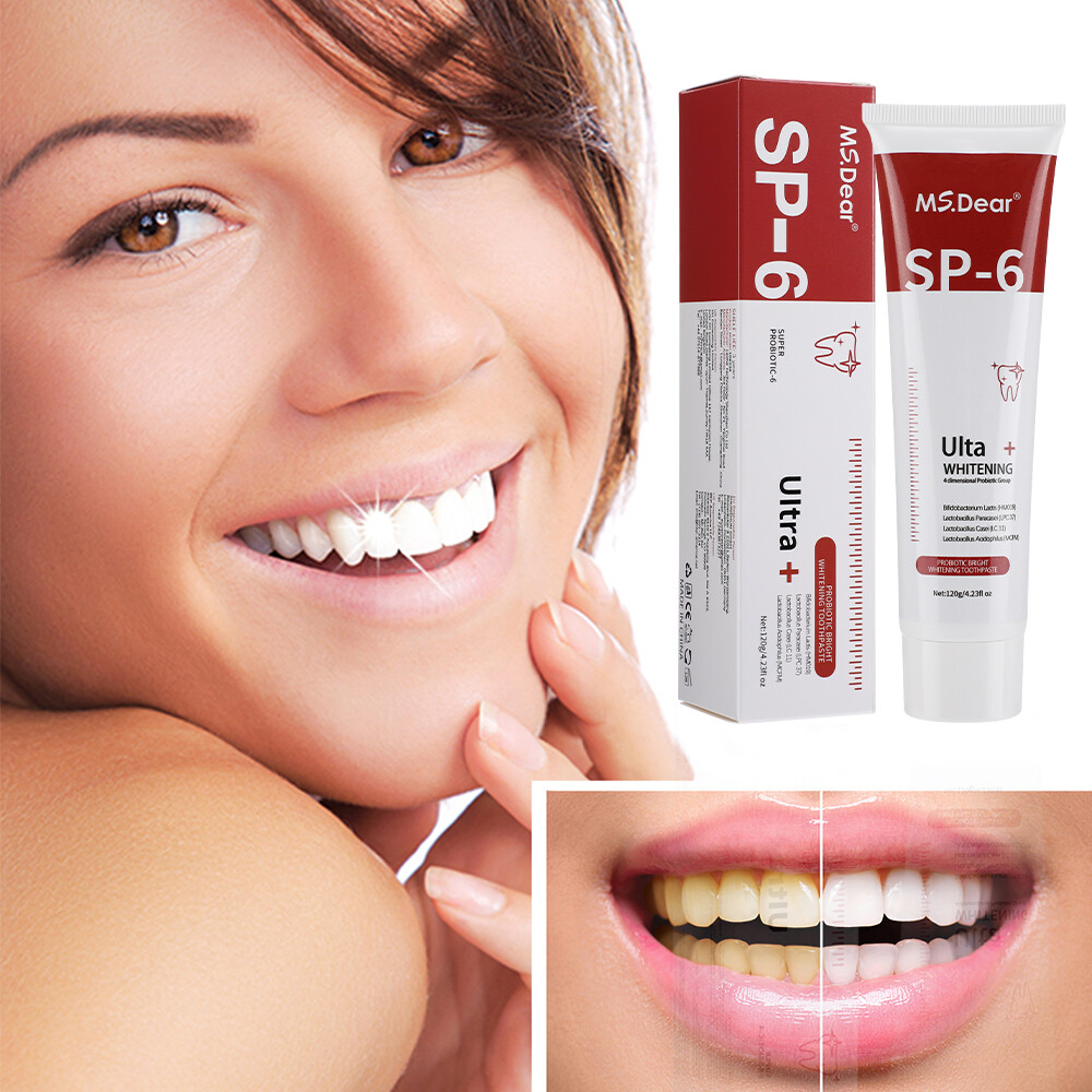 SP-6 Probiotic Toothpaste,Sp-6 Toothpaste Ultra Whitening Quick White Toothpaste