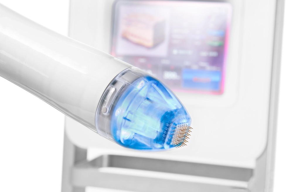 Vivace RF Microneedling Device