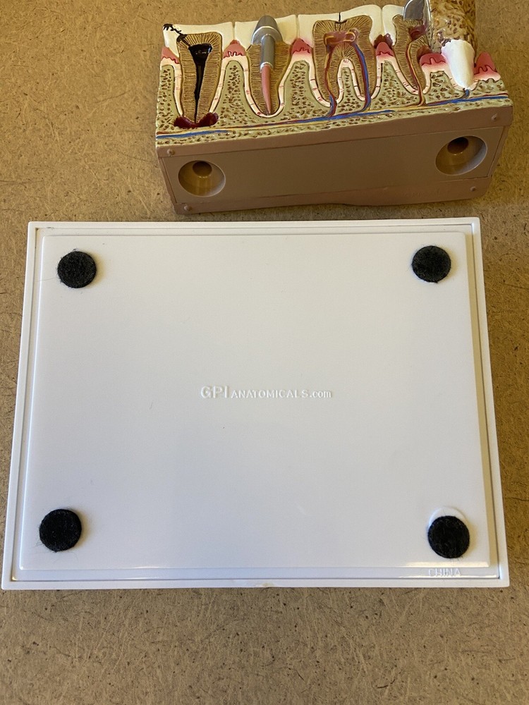 GPI Anatomicals Diseased Teeth & Gums Model