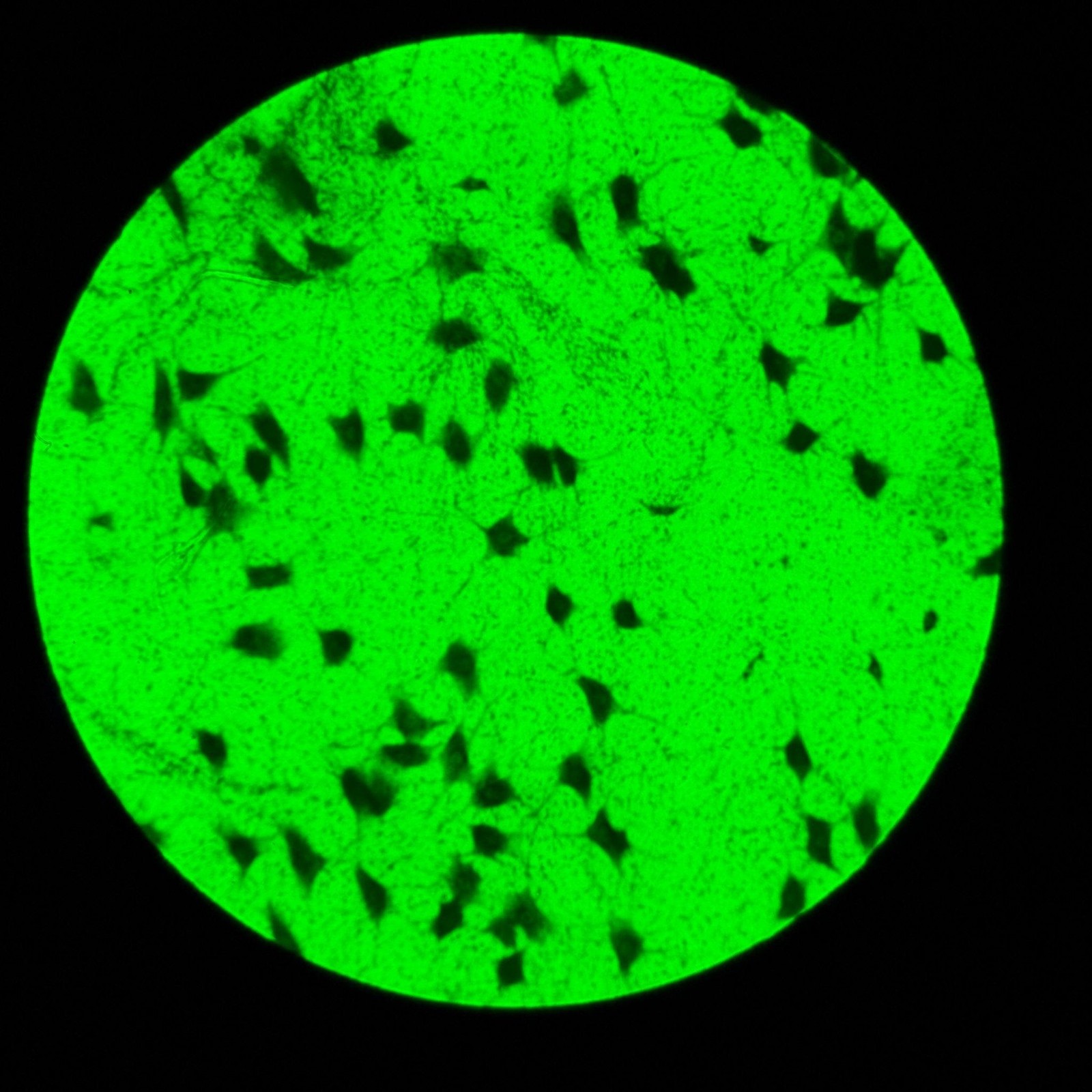 Olympus IX81F-2 Inverted Motorized Microscope w/ IX2-UCB-2 Controller