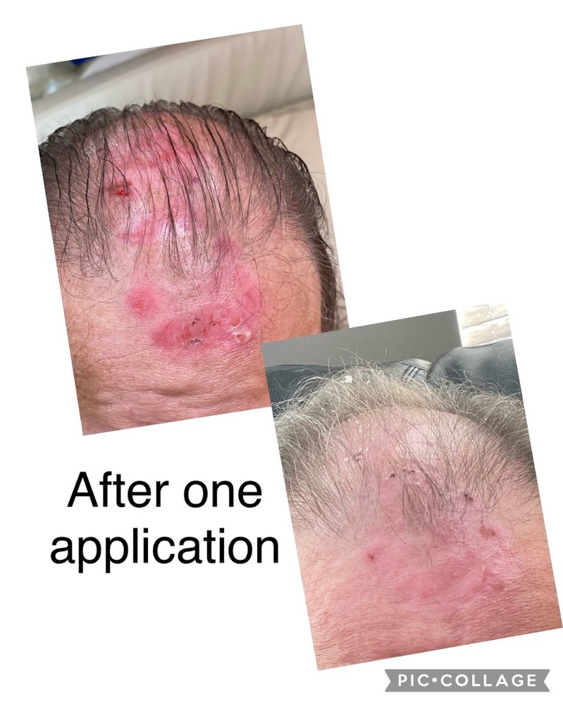 Amazing-O Stabilized Liquid Ozone Improves Energy, Oxygen, Nutrient Absorption
