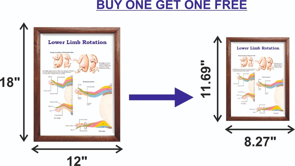 Lower Limb Rotation Chart 12x18 inches