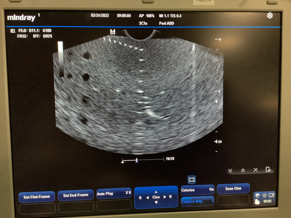 Mindray 3C1s Convex Array Ultrasound Probe