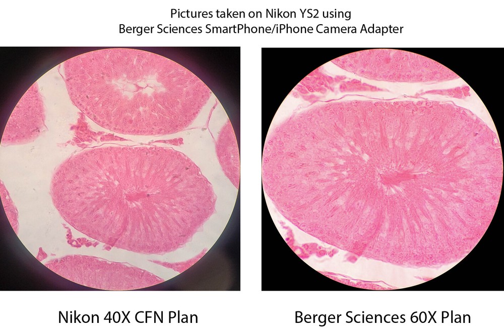 Microscope Eyepiece Camera Adapter for Smartphone/iPhone + 60X Plan Objective