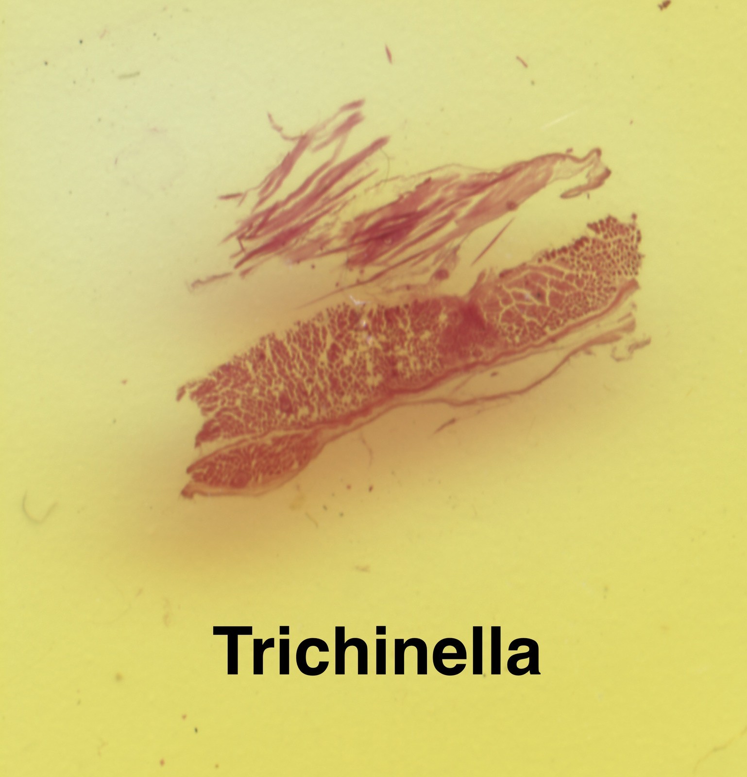 Parasite Microscope Slide Set Deadly Disease Insect Whole Mount Helminth Worm