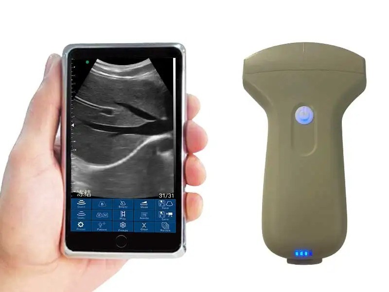 Portable 96E Wireless Ultrasound Scanner Machine w/ Convex Array Probe