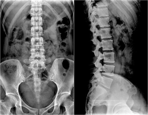 SCRAP X-RAY FILM - 3 LB  (Silver Recovery/Teaching)
