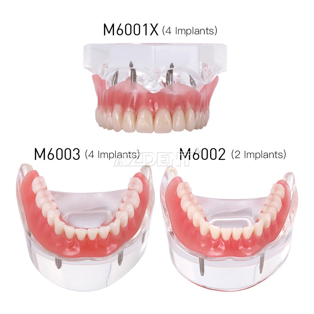 Dental Oral Study Teach Standard Typodont Tissue Decomposition Teaching Model