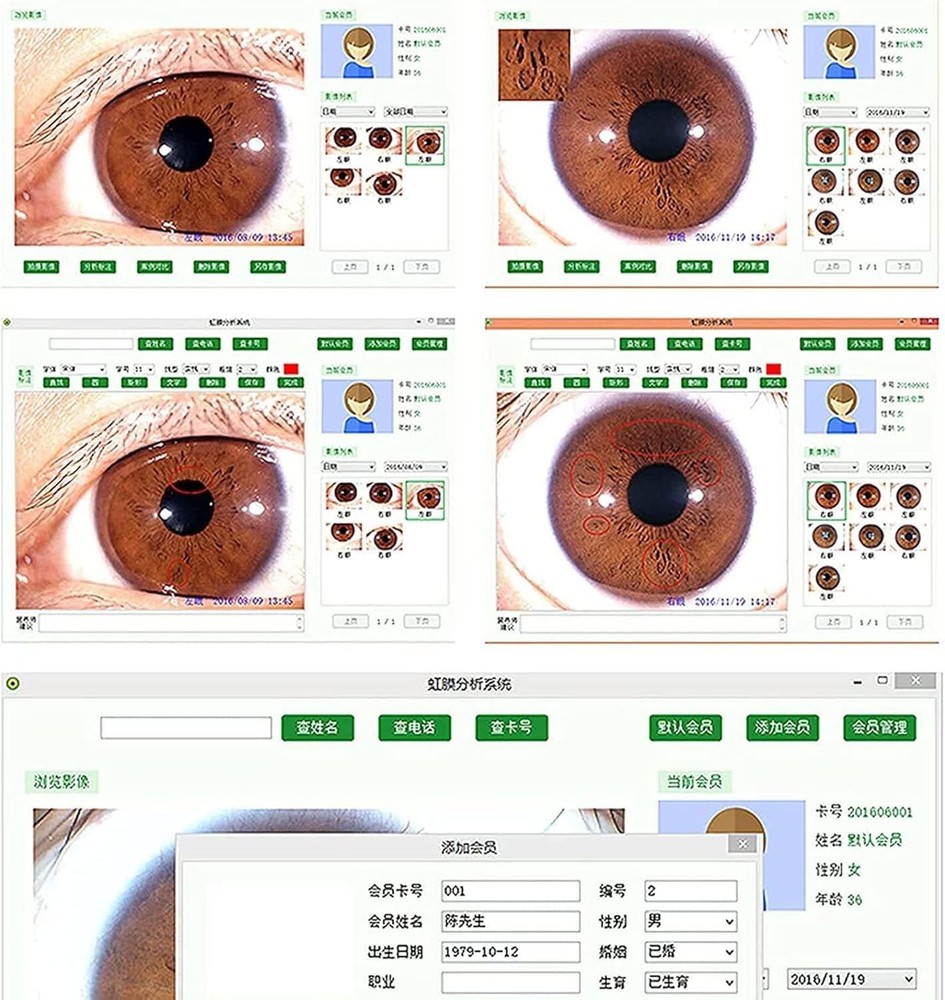 Iris Analyzer Iridology Camera Iridology Analysis Camera with English Software