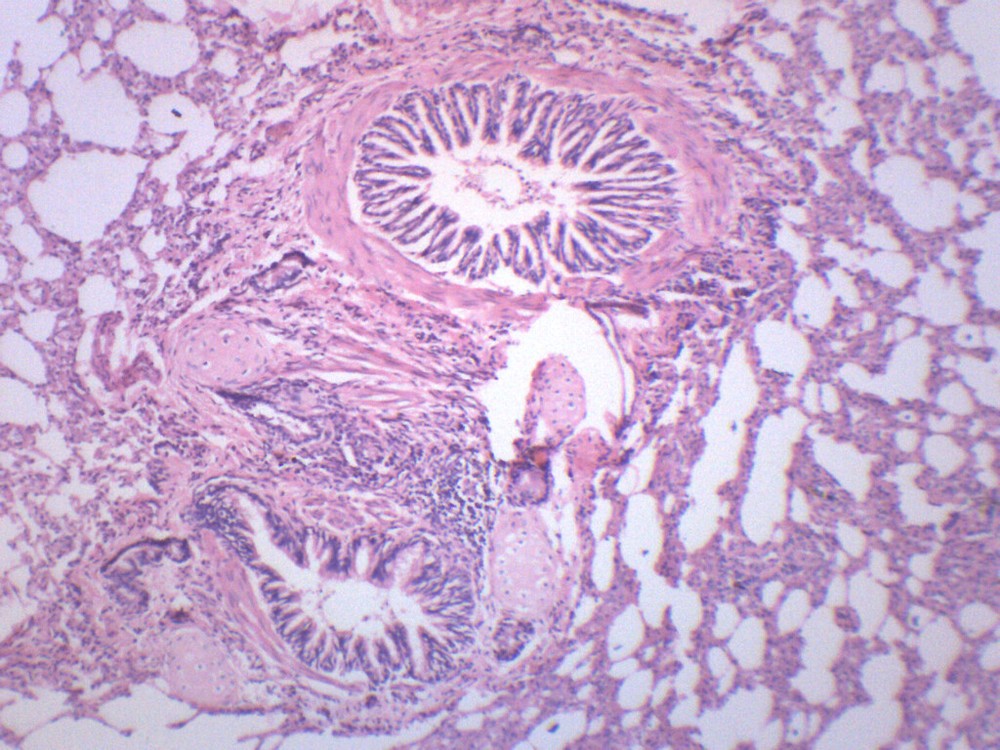 Human Lung Section - Prepared Microscope Slide - 75x25mm - Eisco Labs