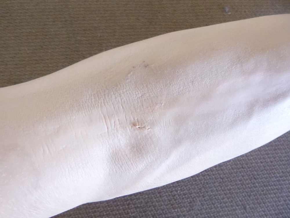 Nasco Life/Form IV Injection Training Arm