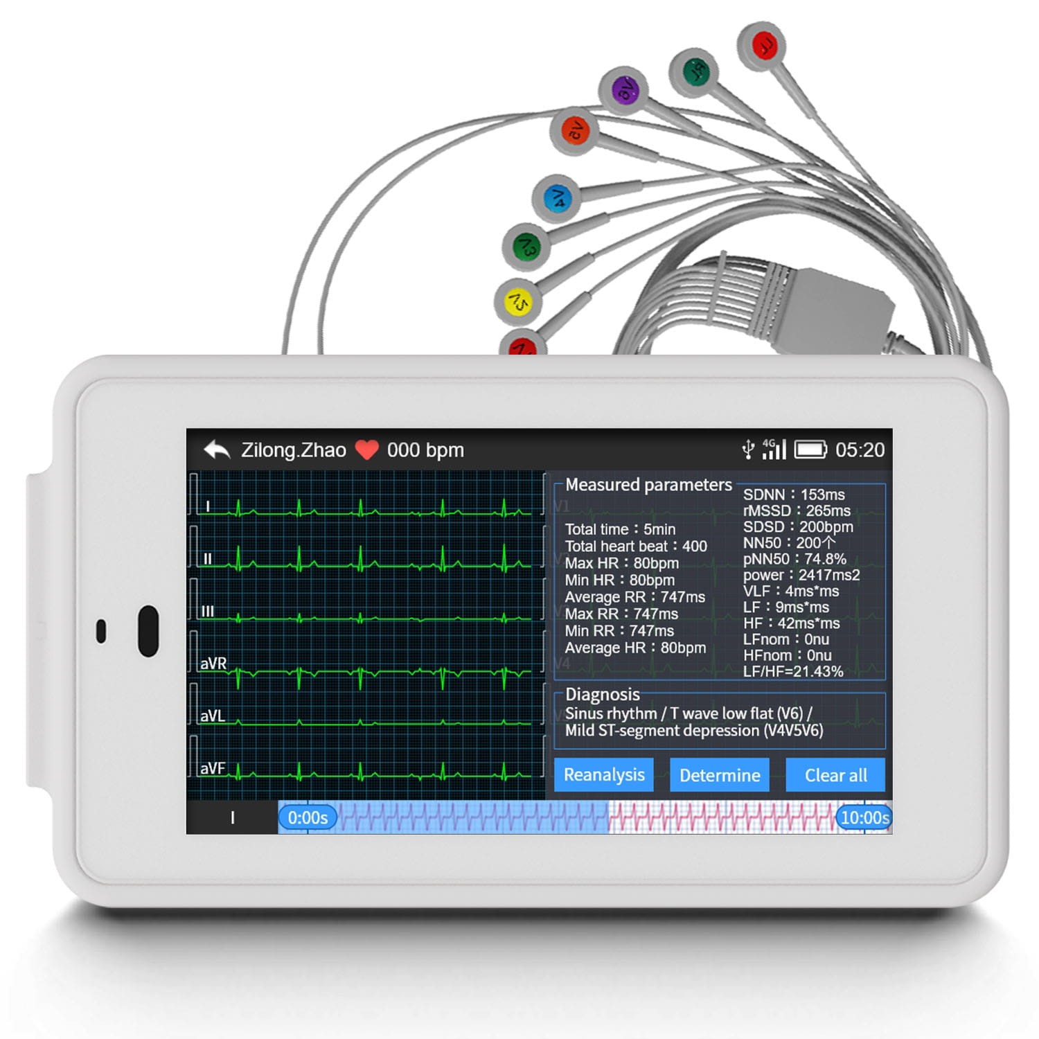 NEW 6/12-lead Electrocardiograph ECG EKG Machine + Glasgow ECG Interpretation