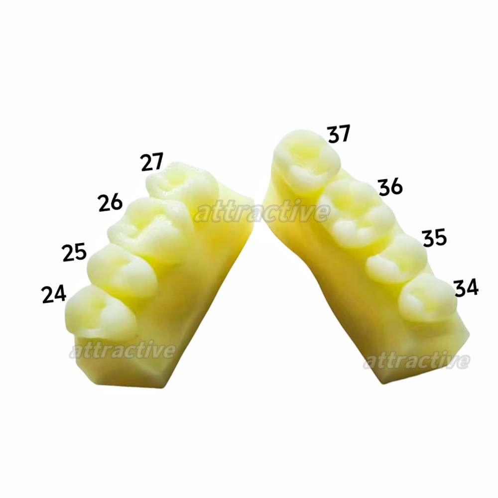 Dental Caries Decay Teeth Model Composite Resin Restore Tooth Simulate Class Ⅱ