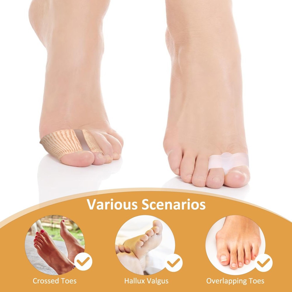 Qianyu 8 Pack Toe Separators Bunion Corrector with 2 Loops Overlapping...