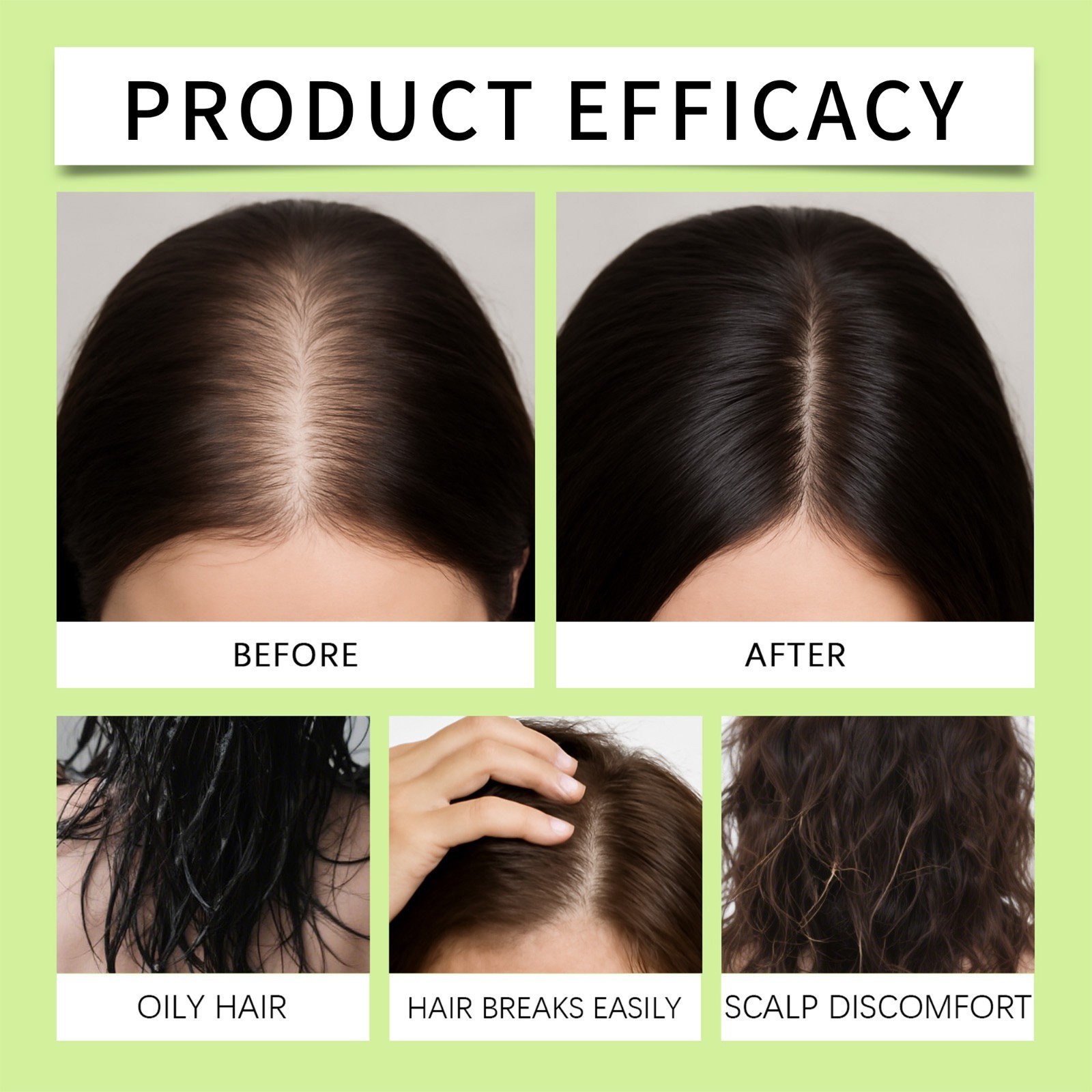 Infuse Hair Regrowth System, Advanced Hair Growth Treatment USA Brand FAST Ship