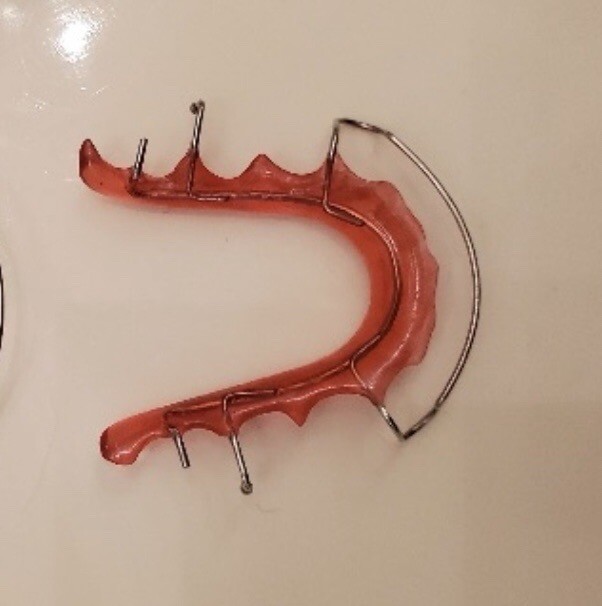 CUSTOM HAWLEY RETAINER Upper New Orthodontic Dental Braces Teeth IMPRESSION KIT