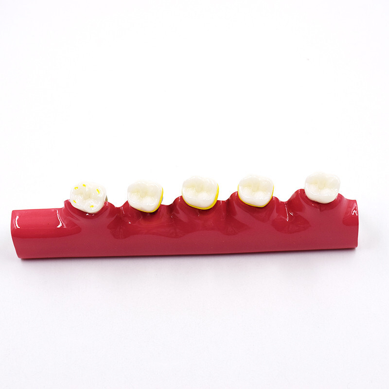 Dental High Quality Assort Dentoform Pathological Study Periodontal Model Teeth