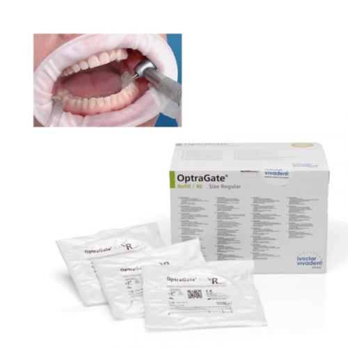 4 x Ivoclar OPTRAGATE 3D Mouth Opener Cheek & Lip Retractor Small/Regular