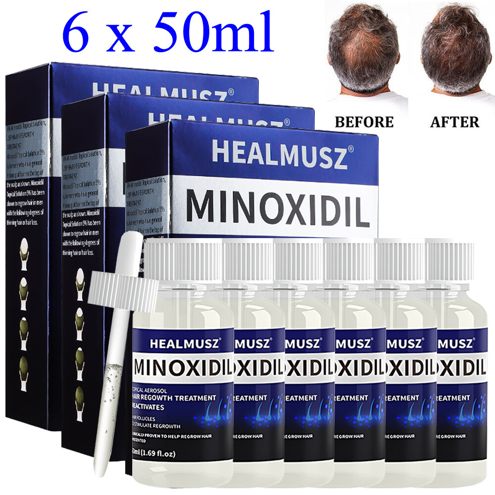 6 Pack Minoxidil 5% Extra Strength Men Hair Regrowth Treatment 6 Month Supply