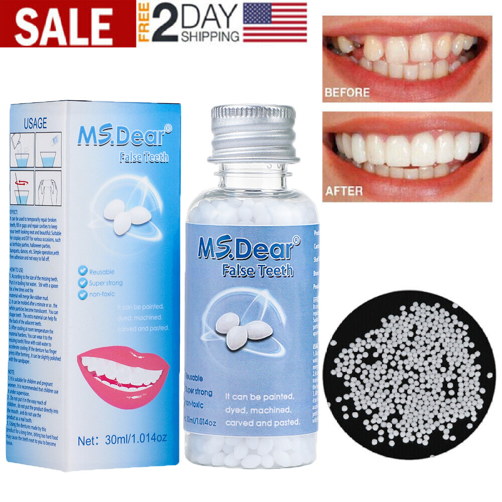 Tooth Repair Kit - Temporary Teeth Replacement Kit for Missing & Broken Teeth US