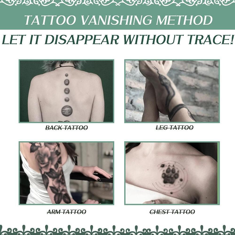 Quick Tattoo Removal Cream Natural Safe Pigment Permanent RemoverSpray J6R1