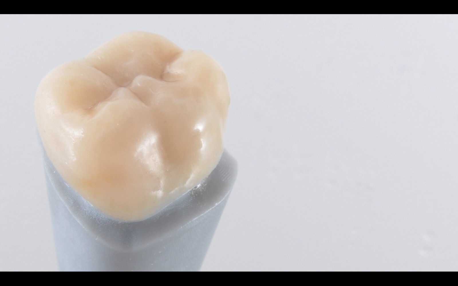 DLP SLA LCD 3d printer permenant crown - teeth resin ..