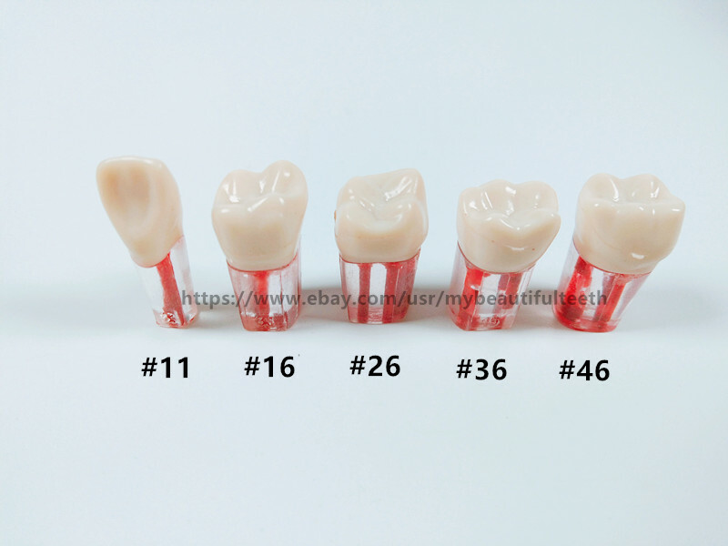 10Pcs Dental Root Canal Study Practice Model Red Pulp Files Molar Anterior Crown