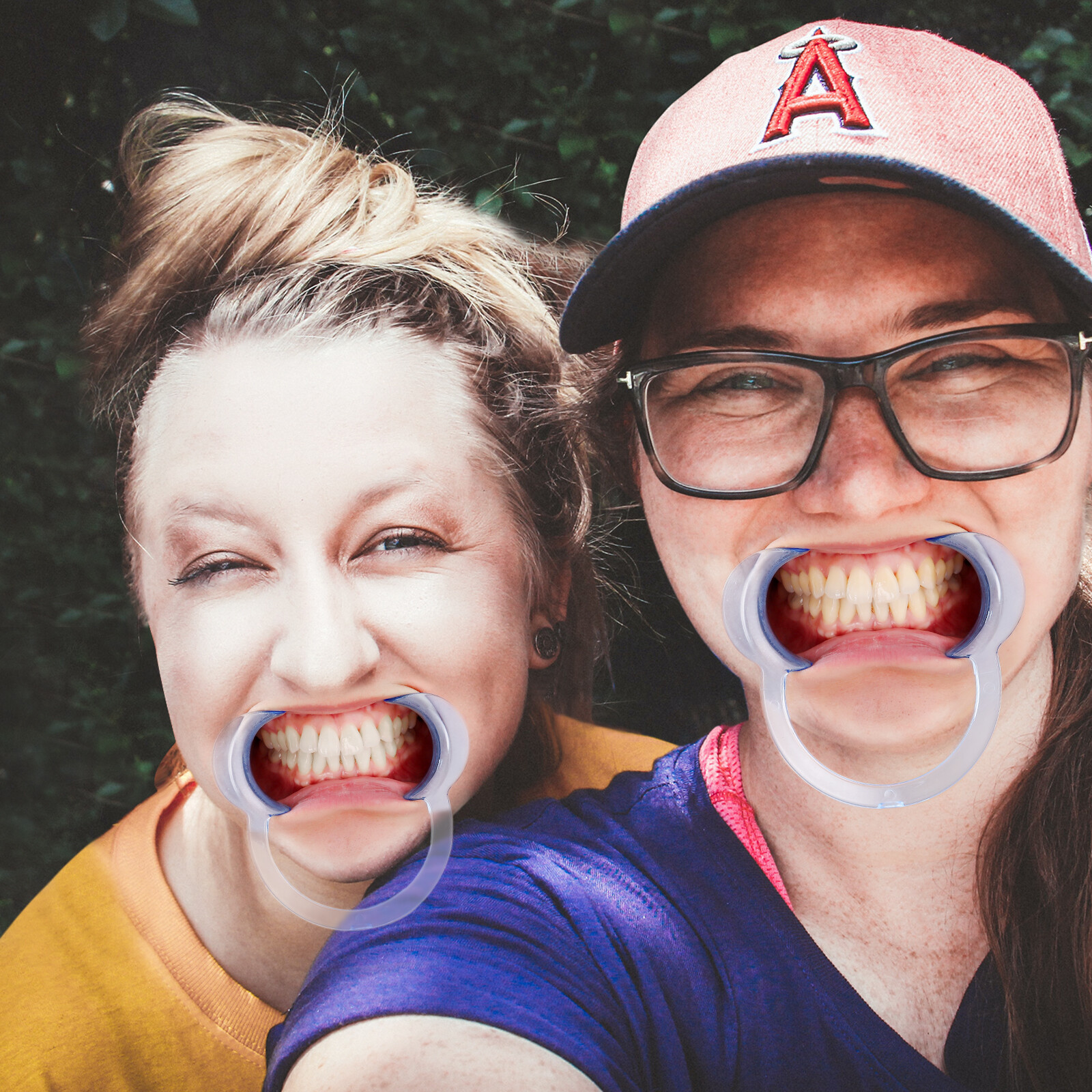 JMU Dental Teeth Whitening Cheek Lip Retractor Mouth Opener Expander S+M+L