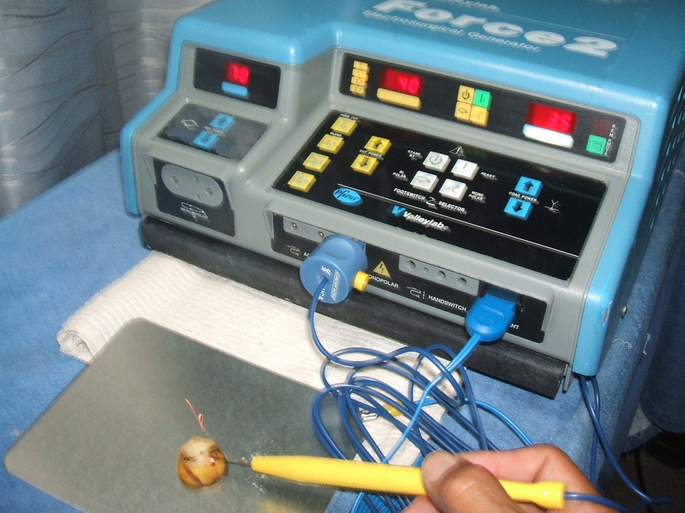 Valleylab Force 2 ESU, Pt. Ready, Nice/Clean/In Great Working Condition, Cert'd