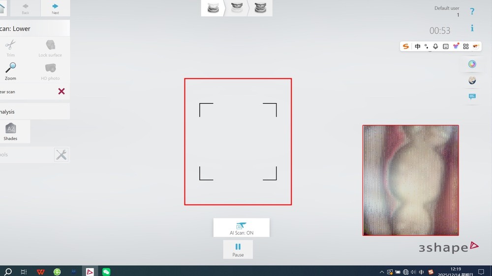 3shape trios3 repair Service