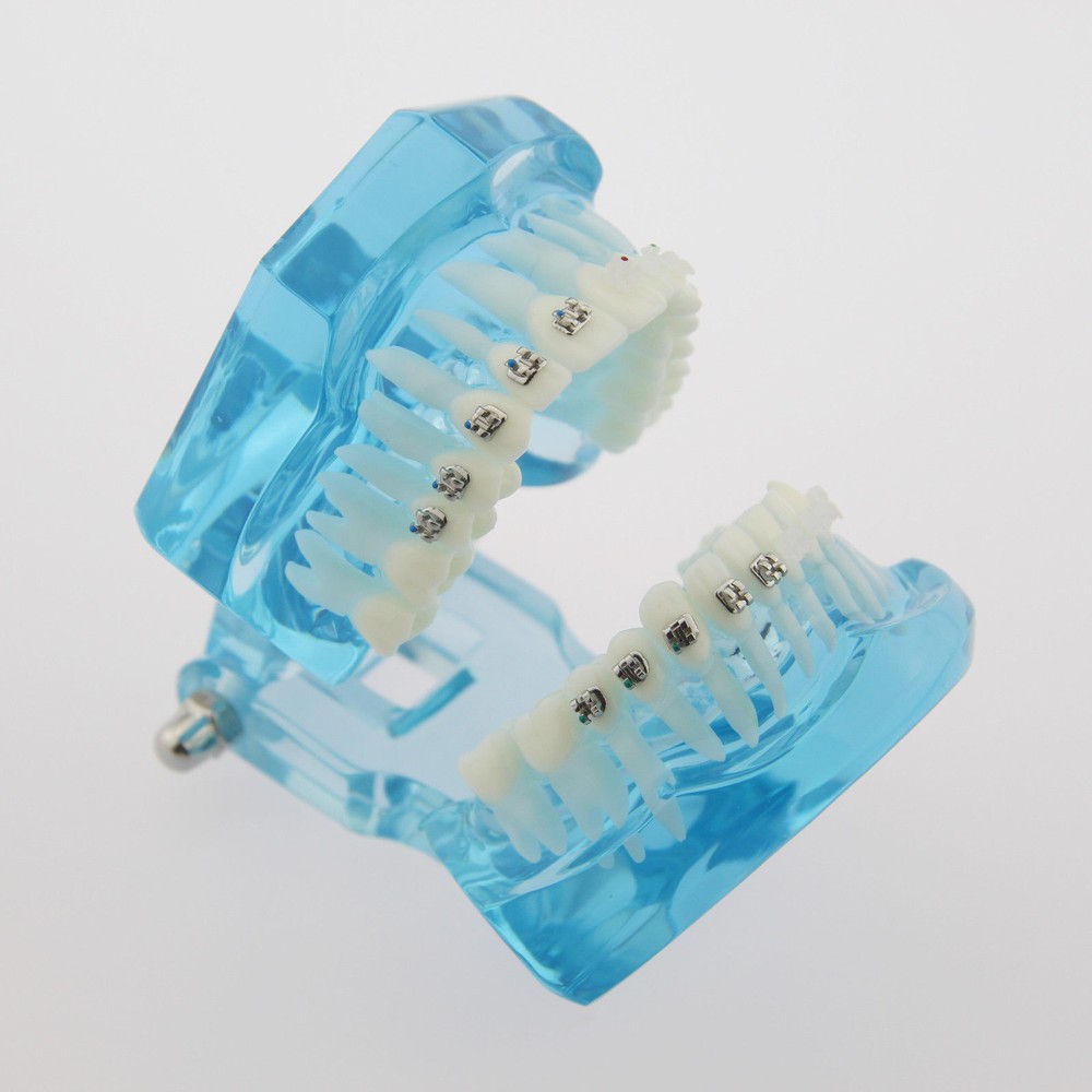 Dental Teach Study Typodont Teeth Model Half Metal Bracket Half Ceramic Bracket