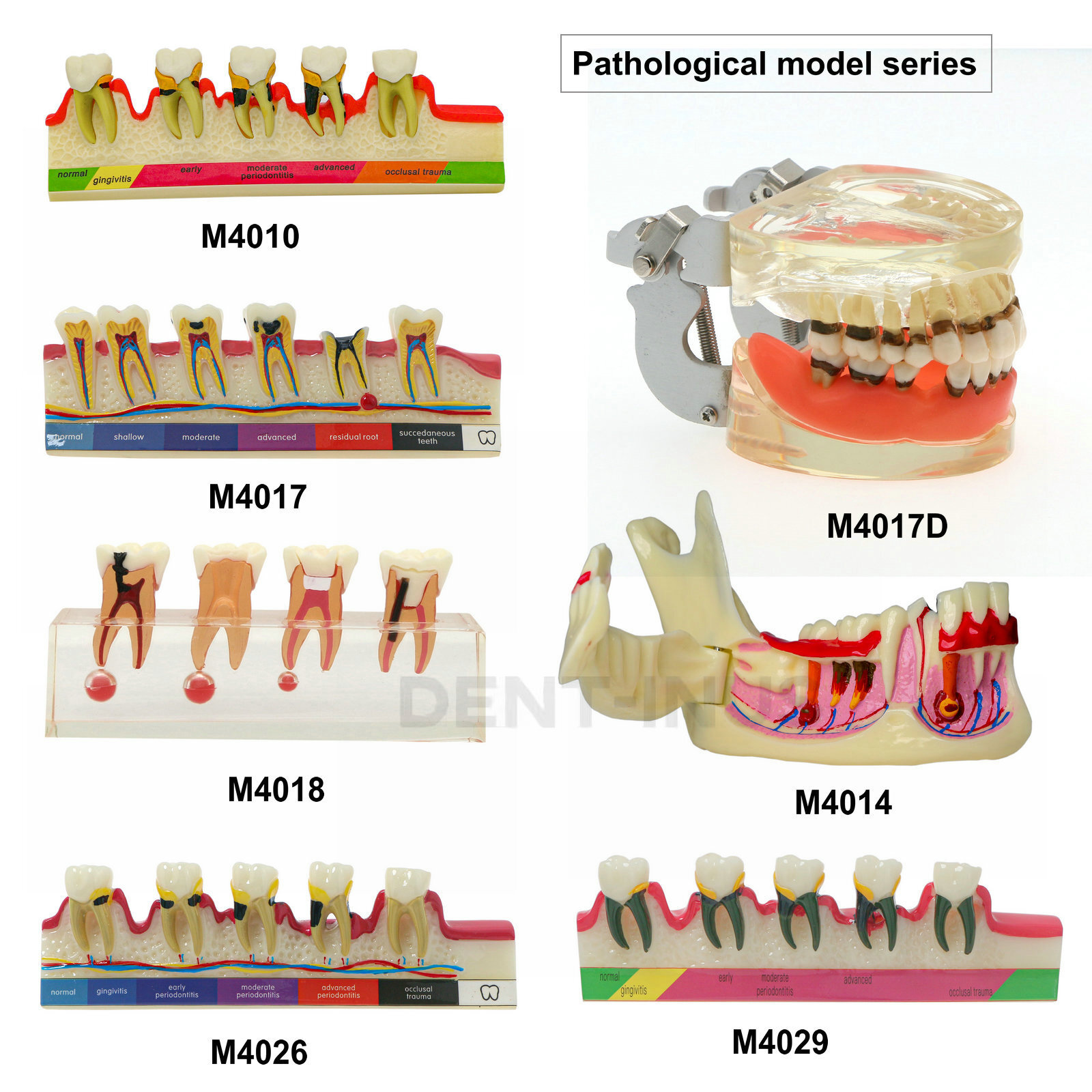 Dental Teeth Model Pathological Typodont Periodontics Endo Disease Assort Demo