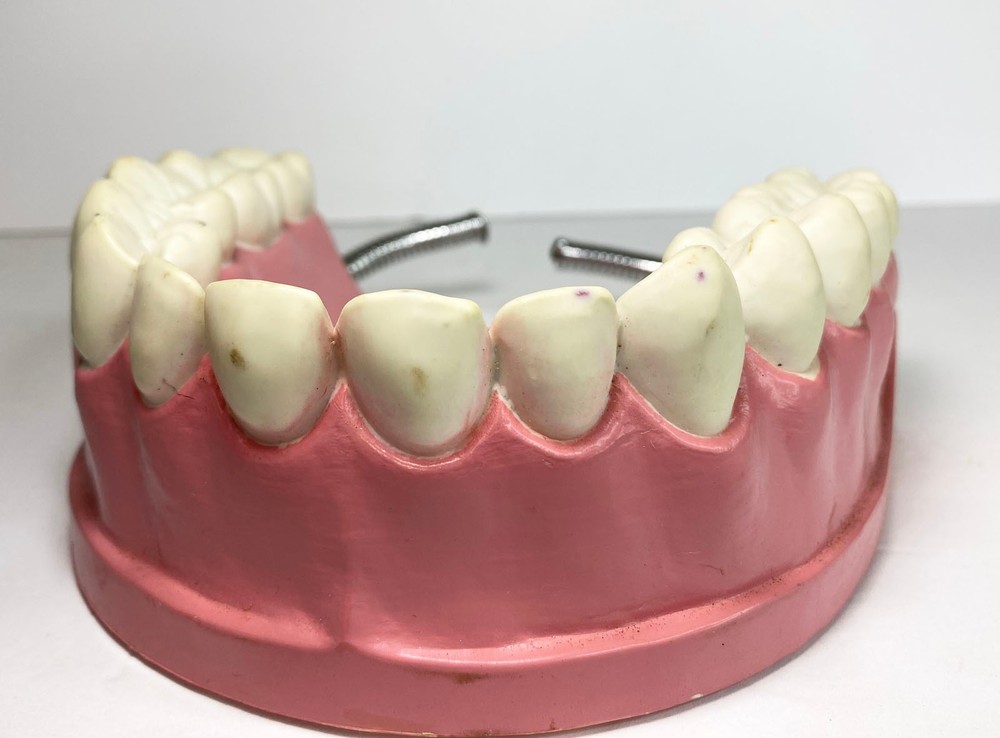 VTG Large Dental Teeth Hygiene Model typodont hinge