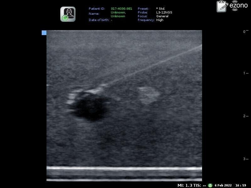 ultrasound phantom training model