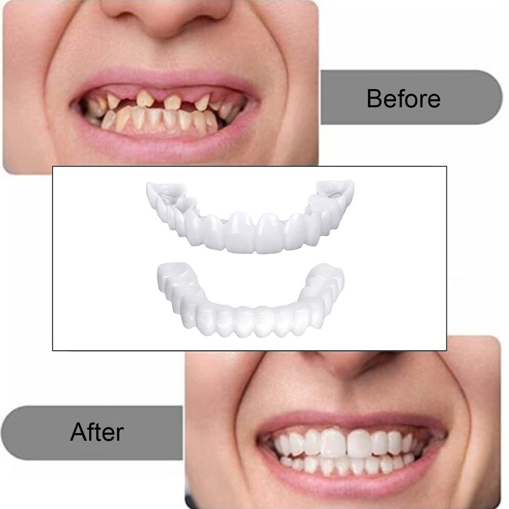 Snap On Veneers Upper & Lower Set - Instant False Teeth Covers No Adhesive bex