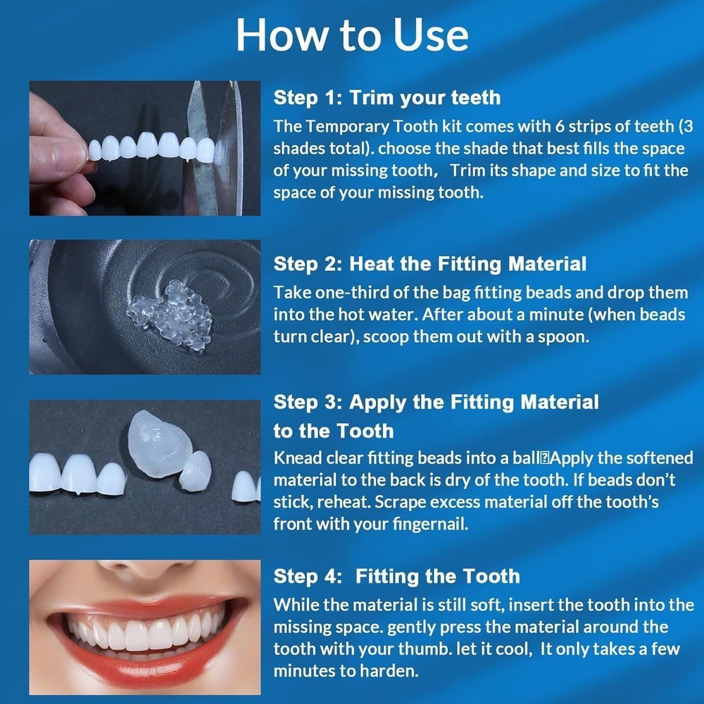 Veneers Teeth for Women, Tooth Replacement Missing Teeth, Upper Veneer 6PCS