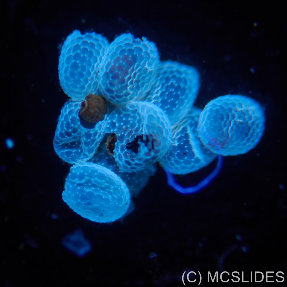 Vintage microscope slide: fluorescence moth eggs for reflected light