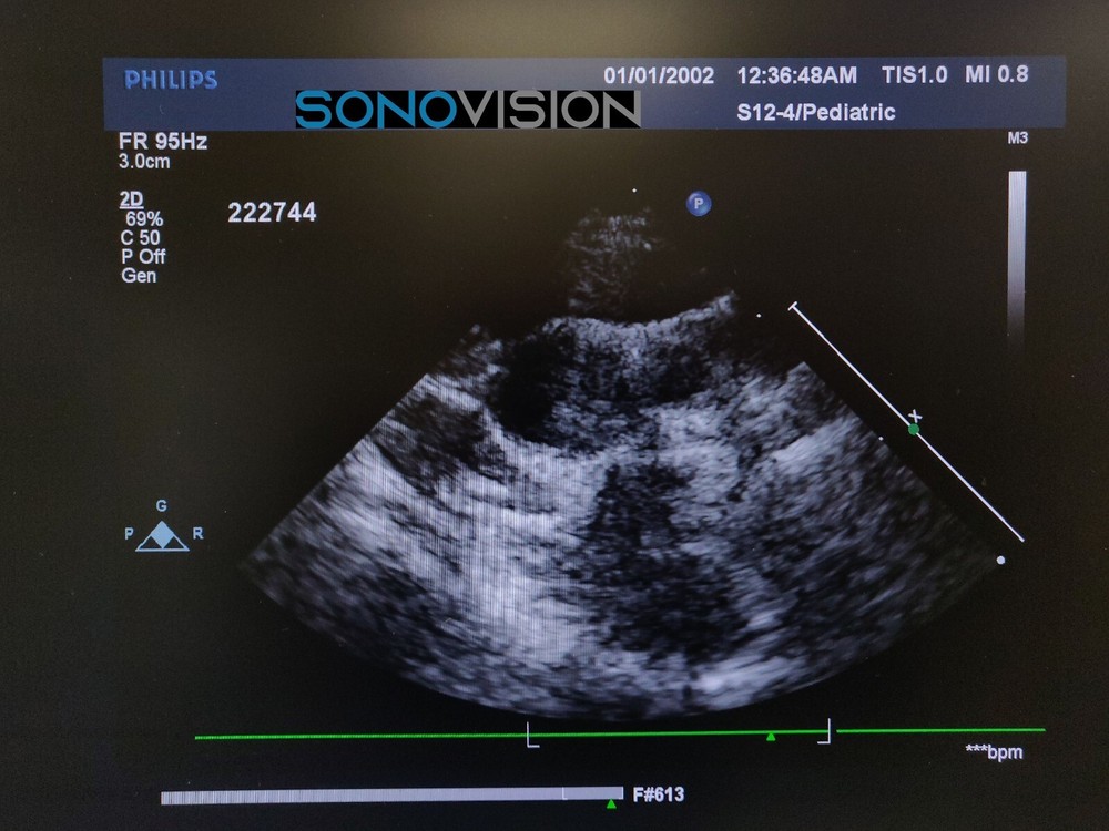 Philips S12-4 (Explora) - 453561270611