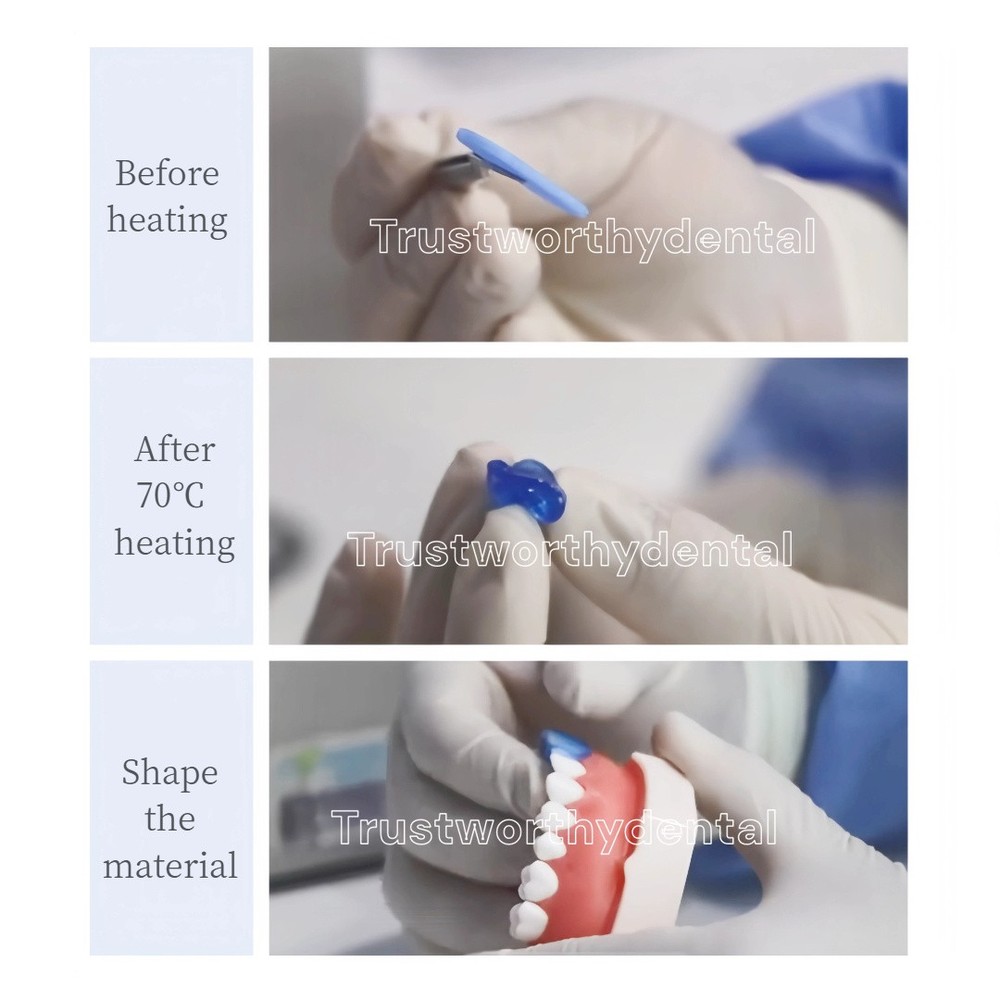Dental Temptabs Thermoplastic Impression Tablets Temporary Crown&Bridge Wax