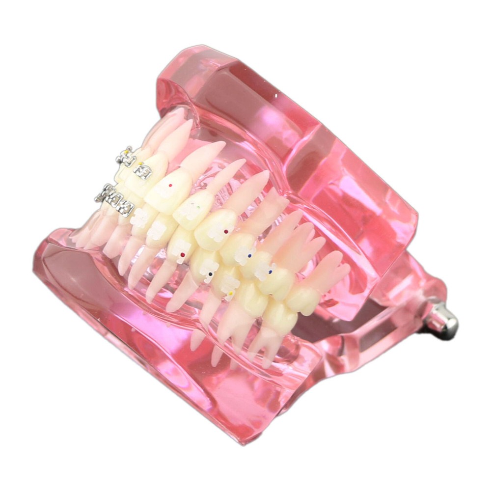 Dental Orthodontic Demonstration Ceramic and Metal Bracket Study Typodont Model