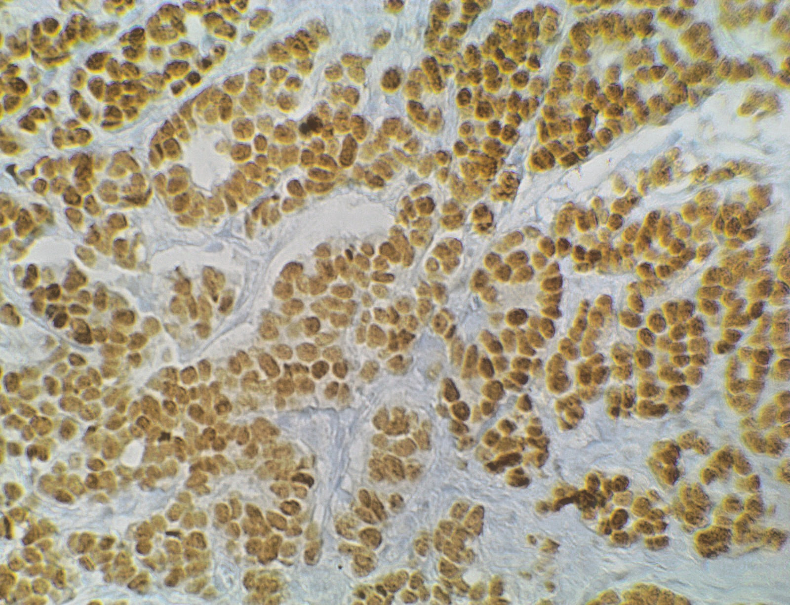 Fisherbrand Research Upright Microscope, (4) OBJECTIVE LENSES, 10MP camera