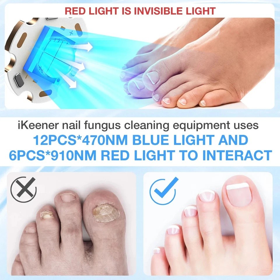 Nail Fungus Laser Nail Fungus Cleaning LED Light Device for Multiple Toenail US