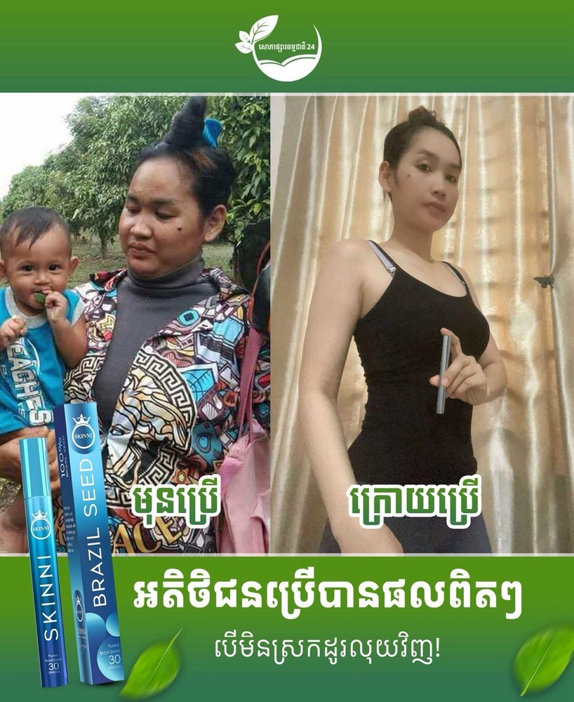 SKINNI Fast Slimគ្រាប់សម្រកធម្មជាតិ ស្គីននី1ប្រអប់( 1ប្រអប់/ 30គ្រាប់ )