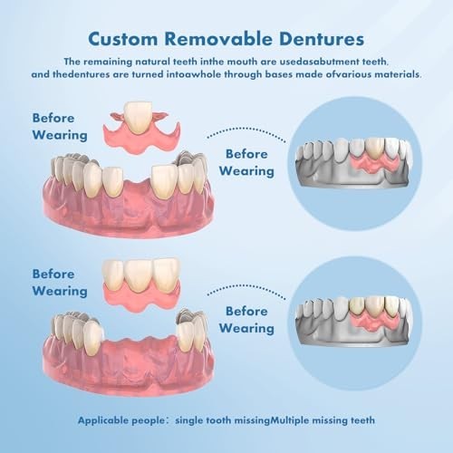 Personalized Removable Dentures - Custom Partial Tooth Replacement Set | Multi-T